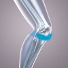 Oppo Health RK100 Neoprene Knee Support Strap